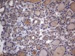 ASM Antibody in Immunohistochemistry (Paraffin) (IHC (P))