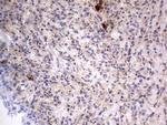 ASM Antibody in Immunohistochemistry (Paraffin) (IHC (P))