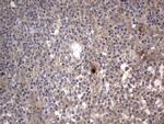 ASM Antibody in Immunohistochemistry (Paraffin) (IHC (P))