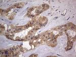 ASM Antibody in Immunohistochemistry (Paraffin) (IHC (P))