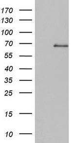 ASM Antibody in Western Blot (WB)