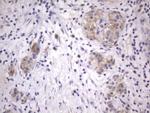 ITGB1BP1 Antibody in Immunohistochemistry (Paraffin) (IHC (P))