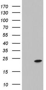 ITGB1BP1 Antibody in Western Blot (WB)