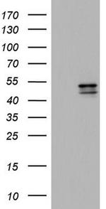 CK1 epsilon Antibody in Western Blot (WB)