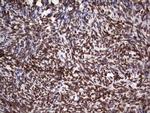 CK1 epsilon Antibody in Immunohistochemistry (Paraffin) (IHC (P))