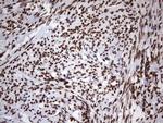 CK1 epsilon Antibody in Immunohistochemistry (Paraffin) (IHC (P))