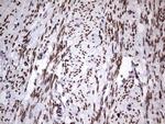 CK1 epsilon Antibody in Immunohistochemistry (Paraffin) (IHC (P))