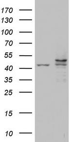 CK1 epsilon Antibody in Western Blot (WB)