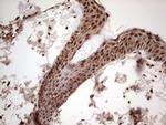 GLI1 Antibody in Immunohistochemistry (Paraffin) (IHC (P))