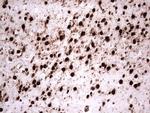 GLI1 Antibody in Immunohistochemistry (Paraffin) (IHC (P))