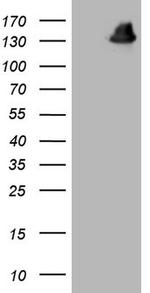 GLI1 Antibody in Western Blot (WB)