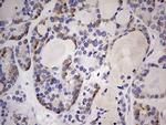 TRIM27 Antibody in Immunohistochemistry (Paraffin) (IHC (P))