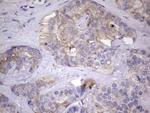 KYNU Antibody in Immunohistochemistry (Paraffin) (IHC (P))