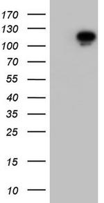 Filensin Antibody in Western Blot (WB)