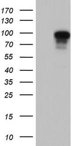 Filensin Antibody in Western Blot (WB)