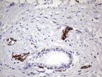 PPP2R5D Antibody in Immunohistochemistry (Paraffin) (IHC (P))