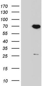 PPP2R5D Antibody in Western Blot (WB)