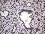 MYF5 Antibody in Immunohistochemistry (Paraffin) (IHC (P))