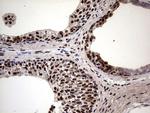 MYF5 Antibody in Immunohistochemistry (Paraffin) (IHC (P))