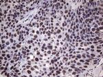 MYF5 Antibody in Immunohistochemistry (Paraffin) (IHC (P))