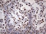 MYF5 Antibody in Immunohistochemistry (Paraffin) (IHC (P))