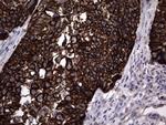 MIP-3 beta Antibody in Immunohistochemistry (Paraffin) (IHC (P))