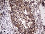 UFD1L Antibody in Immunohistochemistry (Paraffin) (IHC (P))