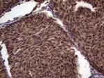 UFD1L Antibody in Immunohistochemistry (Paraffin) (IHC (P))