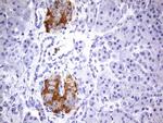 BFSP2 Antibody in Immunohistochemistry (Paraffin) (IHC (P))