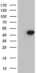 BFSP2 Antibody in Western Blot (WB)