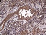 BFSP2 Antibody in Immunohistochemistry (Paraffin) (IHC (P))