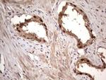 BFSP2 Antibody in Immunohistochemistry (Paraffin) (IHC (P))