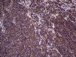 BFSP2 Antibody in Immunohistochemistry (Paraffin) (IHC (P))