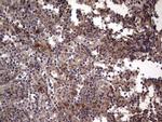 BFSP2 Antibody in Immunohistochemistry (Paraffin) (IHC (P))