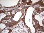 BFSP2 Antibody in Immunohistochemistry (Paraffin) (IHC (P))