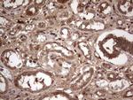 BFSP2 Antibody in Immunohistochemistry (Paraffin) (IHC (P))