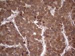 BFSP2 Antibody in Immunohistochemistry (Paraffin) (IHC (P))