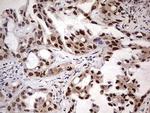 NAE1 Antibody in Immunohistochemistry (Paraffin) (IHC (P))