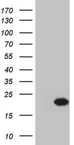 Centrin 1 Antibody in Western Blot (WB)