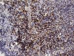 IKZF3 Antibody in Immunohistochemistry (Paraffin) (IHC (P))