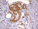 IKZF3 Antibody in Immunohistochemistry (Paraffin) (IHC (P))