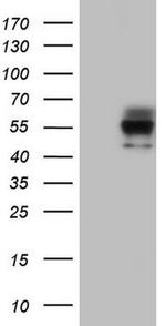 POMK Antibody in Western Blot (WB)