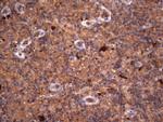 RSPO3 Antibody in Immunohistochemistry (Paraffin) (IHC (P))