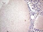 SNX12 Antibody in Immunohistochemistry (Paraffin) (IHC (P))