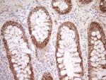 Calpain 5 Antibody in Immunohistochemistry (Paraffin) (IHC (P))