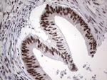 PPP1R8 Antibody in Immunohistochemistry (Paraffin) (IHC (P))