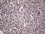 PPP1R8 Antibody in Immunohistochemistry (Paraffin) (IHC (P))