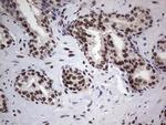 PPP1R8 Antibody in Immunohistochemistry (Paraffin) (IHC (P))