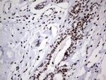 PPP1R8 Antibody in Immunohistochemistry (Paraffin) (IHC (P))