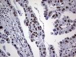 PPP1R8 Antibody in Immunohistochemistry (Paraffin) (IHC (P))